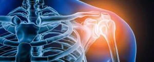 Osteoarticular-Tecnifar